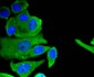 Neuropilin-1 Recombinant Rabbit mAb